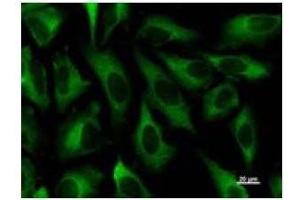 Immunostaining analysis in HeLa cells. (ZW10 anticorps)
