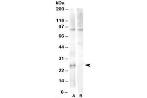 Western blot testing of human heart lysate with APOBEC2 antibody at 1ug/ml with [B] and without [A] blocking peptide. (APOBEC2 anticorps)