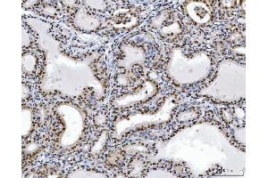IHC analysis of RCC1 using anti-RCC1 antibody (ABIN7600022). (RCC1 anticorps  (AA 14-421))
