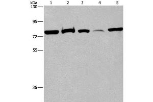Western Blot analysis of 293T cell, Human fetal brain tissue and K562 cell, Human fetal liver tissue and Hela cell using ACVR2A Polyclonal Antibody at dilution of 1:400