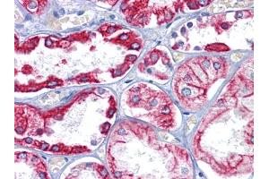 Immunohistochemical analysis of paraffin-embedded human Kidney tissues using CK8 mouse mAb (KRT8 anticorps)