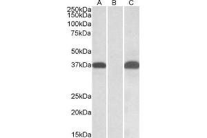 HEK293 lysate (10ug protein in RIPA buffer) overexpressing Human PIM2 with C-terminal MYC tag probed with ABIN1590033 (0.