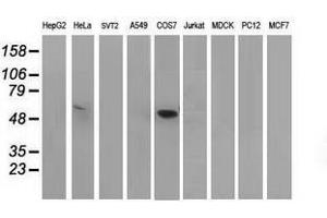 Image no. 2 for anti-Tumor Protein P53 (TP53) antibody (ABIN1499976)