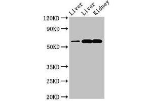 Western Blot Positive WB detected in: Rat liver tissue, Mouse liver tissue, Mouse kidney tissue All lanes: ZNF695 antibody at 3. (ZNF695 anticorps  (AA 1-88))