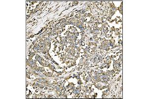 IHC analysis of HCCS using anti-HCCS antibody (ABIN7602424). (HCCS anticorps  (AA 76-268))