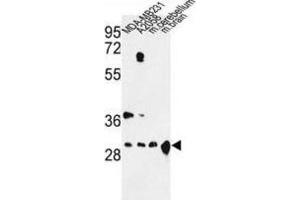 Western Blotting (WB) image for anti-14-3-3 zeta (YWHAZ) antibody (ABIN3003721) (14-3-3 zeta anticorps)