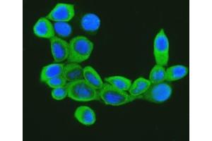 anti-Cofilin 1 (CFL1) (AA 122-152), (C-Term) antibody
