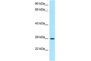 WB Suggested Anti-TNIP3 Antibody Titration: 1. (TNIP3 anticorps  (N-Term))