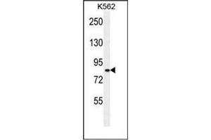 Western blot analysis of Whirlin  Antibody  in K562 cell line lysates (35ug/lane). (DFNB31 anticorps  (Middle Region))