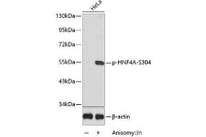 Western blot analysis of extracts from HeLa cells using Phospho-HNF4A(S304) Polyclonal Antibody. (HNF4A anticorps  (pSer304))