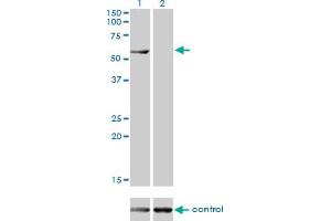 Western blot analysis of CESK1 over-expressed 293 cell line, cotransfected with CESK1 Validated Chimera RNAi (Lane 2) or non-transfected control (Lane 1). (CCT8L2 anticorps  (AA 1-557))