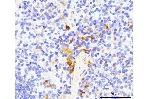 IHC analysis of TRAP/CD40L/Cd40lg using anti-TRAP/CD40L/Cd40lg antibody (ABIN7599747).