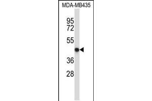 Western blot analysis in MDA-MB435 cell line lysates (35ug/lane). (NFE2 anticorps  (C-Term))