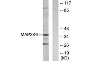 Western Blotting (WB) image for anti-Mitogen-Activated Protein Kinase Kinase 6 (MAP2K6) (AA 1-50) antibody (ABIN2889508) (MAP2K6 anticorps  (AA 1-50))