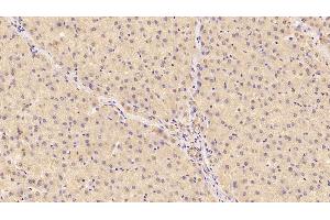 Detection of CDNF in Human Liver Tissue using Monoclonal Antibody to Cerebral Dopamine Neurotrophic Factor (CDNF)