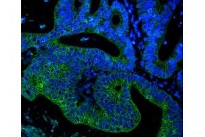 IF analysis of Cytokeratin 18 using anti-Cytokeratin 18 antibody (ABIN7600573). (Cytokeratin 18 anticorps  (AA 204-430))