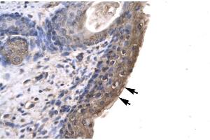 Human Spermatophore (RLIM anticorps  (C-Term))
