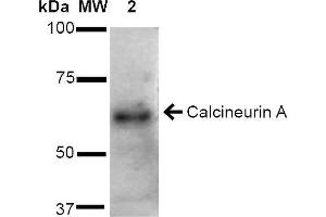 Western blot analysis of Rat Brain cell lysates showing detection of ~61 kDa Calcineurin A protein using Rabbit Anti-Calcineurin A Polyclonal Antibody . (Calcineurin A anticorps  (AA 264-283) (FITC))