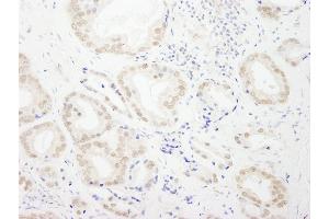 Immunohistochemistry (IHC) image for anti-General Transcription Factor IIIC, Polypeptide 4 (GTF3C4) (AA 625-675) antibody (ABIN7453562)