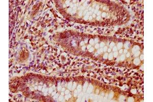 IHC image of ABIN7161789 diluted at 1:1200 and staining in paraffin-embedded human appendix tissue performed on a Leica BondTM system.