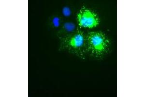 Image no. 1 for anti-Keratin 18 (KRT18) (AA 69-372) antibody (ABIN1491638) (Cytokeratin 18 anticorps  (AA 69-372))