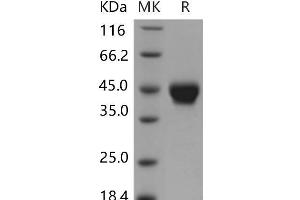 Western Blotting (WB) image for ST6 (Alpha-N-Acetyl-Neuraminyl-2,3-beta-Galactosyl-1,3)-N-Acetylgalactosaminide alpha-2,6-Sialyltransferase 2 (ST6GALNAC2) protein (His tag) (ABIN7320149) (ST6GALNAC2 Protein (His tag))