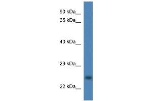 WB Suggested Anti-CCS Antibody Titration: 1. (Superoxide dismutase copper chaperone anticorps  (Middle Region))
