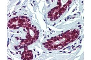 FUBP3 antibody was used for immunohistochemistry at a concentration of 4-8 ug/ml. (FUBP3 anticorps  (Middle Region))