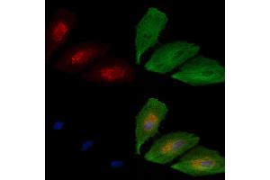 ABIN6266034 and ABIN6277649 staining  cells by IF/ICC.
