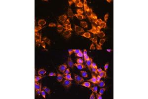 Immunofluorescence analysis of NIH-3T3 cells using  antibody  at dilution of 1:100. (ACAT1 anticorps)