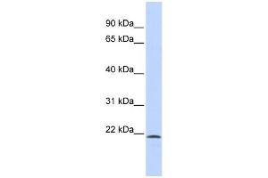 WB Suggested Anti-SCML1 Antibody Titration:  0. (SCML1 anticorps  (N-Term))
