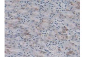 DAB staining on IHC-P;;Samples: Rat Kidney Tissue (HSPB6 anticorps  (AA 1-162))