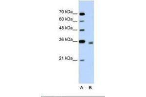 Image no. 1 for anti-2,4-Dienoyl CoA Reductase 2, Peroxisomal (DECR2) (N-Term) antibody (ABIN320805) (DECR2 anticorps  (N-Term))