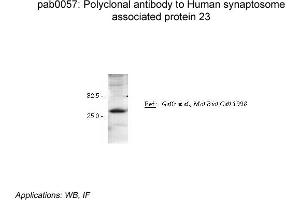 Image no. 2 for anti-Synaptosomal-Associated Protein, 23kDa (SNAP23) antibody (ABIN347011) (SNAP23 anticorps)