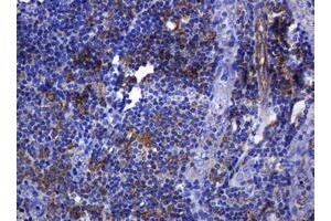 Immunohistochemistry (IHC) image for anti-Sterol O-Acyltransferase 2 (SOAT2) (AA 1-120) antibody (ABIN1490565)