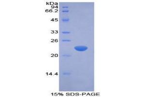 SDS-PAGE (SDS) image for Interferon, beta 1, Fibroblast (IFNB1) (AA 22-180) protein (His tag) (ABIN1878112)