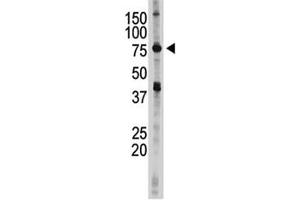 IKKE antibody used in western blot to detect IKKE in 293 cell lysate (IKKi/IKKe anticorps  (AA 686-716))