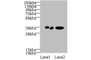 Western blot All lanes: RPRD1A antibody at 2 μg/mL Lane 1: A431 whole cell lysate Lane 2: Jurkat whole cell lysate Secondary Goat polyclonal to Rabbit IgG at 1/10000 dilution Predicted band size: 36, 32 kDa Observed band size: 36 kDa (RPRD1A anticorps  (AA 2-276))