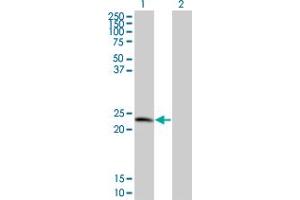 Western Blot analysis of TPD52 expression in transfected 293T cell line by TPD52 monoclonal antibody (M01), clone 1B6. (TPD52 anticorps  (AA 100-184))