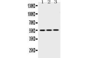 Western blot analysis of Caspase8 using anti-Caspase8 antibody . (Caspase 8 anticorps  (N-Term))