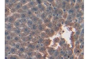 Detection of GSTk1 in Mouse Liver Tissue using Polyclonal Antibody to Glutathione S Transferase Kappa 1 (GSTk1)