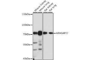 Western blot analysis of extracts of various cell lines, using  antibody (ABIN7269964) at 1:1000 dilution. (ARHGAP22 anticorps  (AA 510-650))
