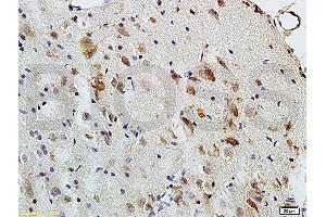 Formalin-fixed and paraffin embedded: rat brain tissue labeled with Anti-MBP Polyclonal Antibody (ABIN739400), Unconjugated at 1:200, followed by conjugation to the secondary antibody and DAB staining (MBP anticorps  (AA 69-85))