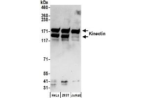 anti-Kinectin 1 (Kinesin Receptor) (KTN1) (AA 150-200) antibody