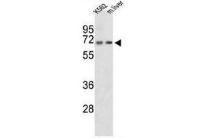 Western blot analysis of CROT Antibody (N-term) in K562 cell line and mouse liver tissue lysates (35µg/lane). (CROT anticorps  (N-Term))
