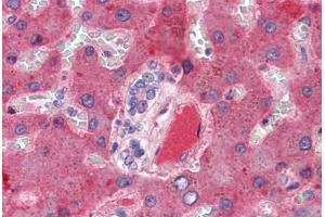 Liver, vessel: Formalin-Fixed, Paraffin-Embedded (FFPE)