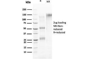 SDS-PAGE Analysis Purified HER-4 / ERBB4 Mouse Monoclonal Antibody (ERBB4/2581). (ERBB4 anticorps  (AA 1116-1269))