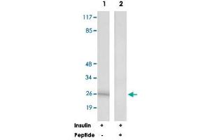 Western blot analysis of extracts from K-562 cells, treated with Insulin (0.