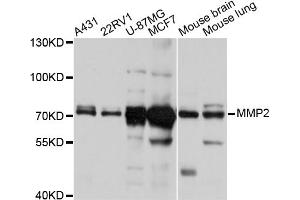 Western blot analysis of extracts of various cell lines, using MMP2 antibody (ABIN5998246) at 1/1000 dilution. (MMP2 anticorps)