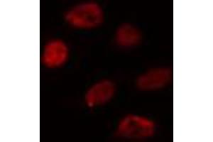 ABIN6274359 staining HuvEc cells by IF/ICC. (WTAP anticorps  (C-Term))